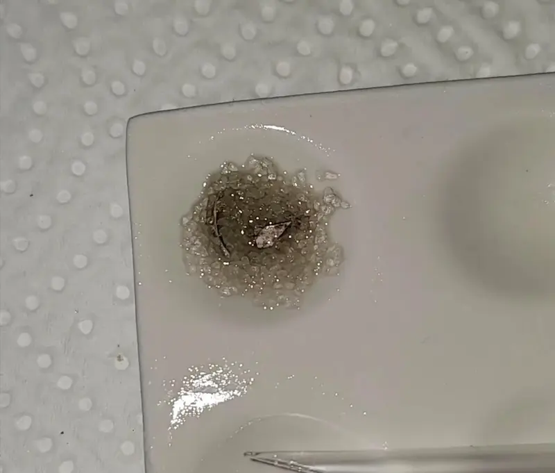 Unusual false negative brown Hofmann reagent result with LSD