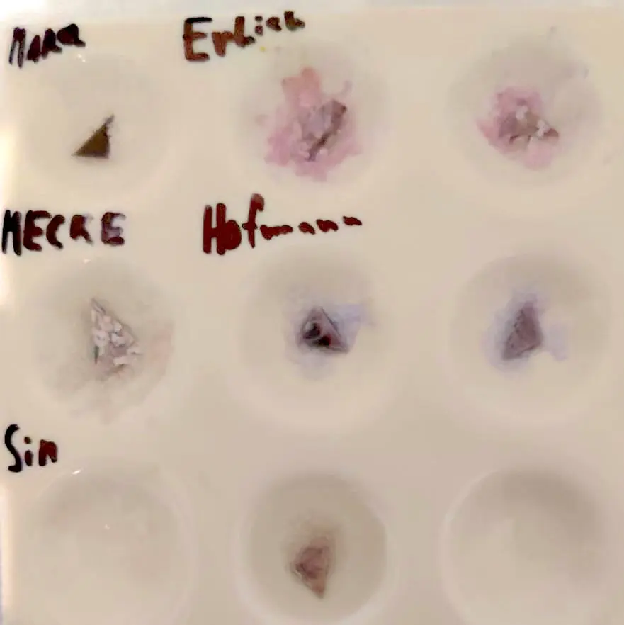 LSD reagent test kit results (source:DM)