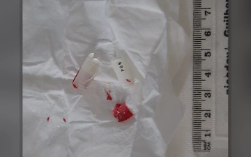 Pregabalin pills (Pregabalin)