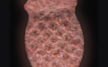 Pina pills (Ecstasy / MDMA)