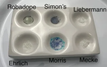 Alpha-PVP, MDPV and NEP: the cathinones that are not MMC