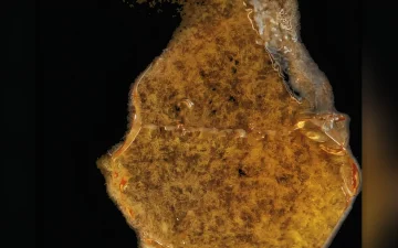Delta-8 cannabis oil