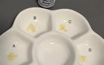 Liebermann reagent: what it detects and where it fails