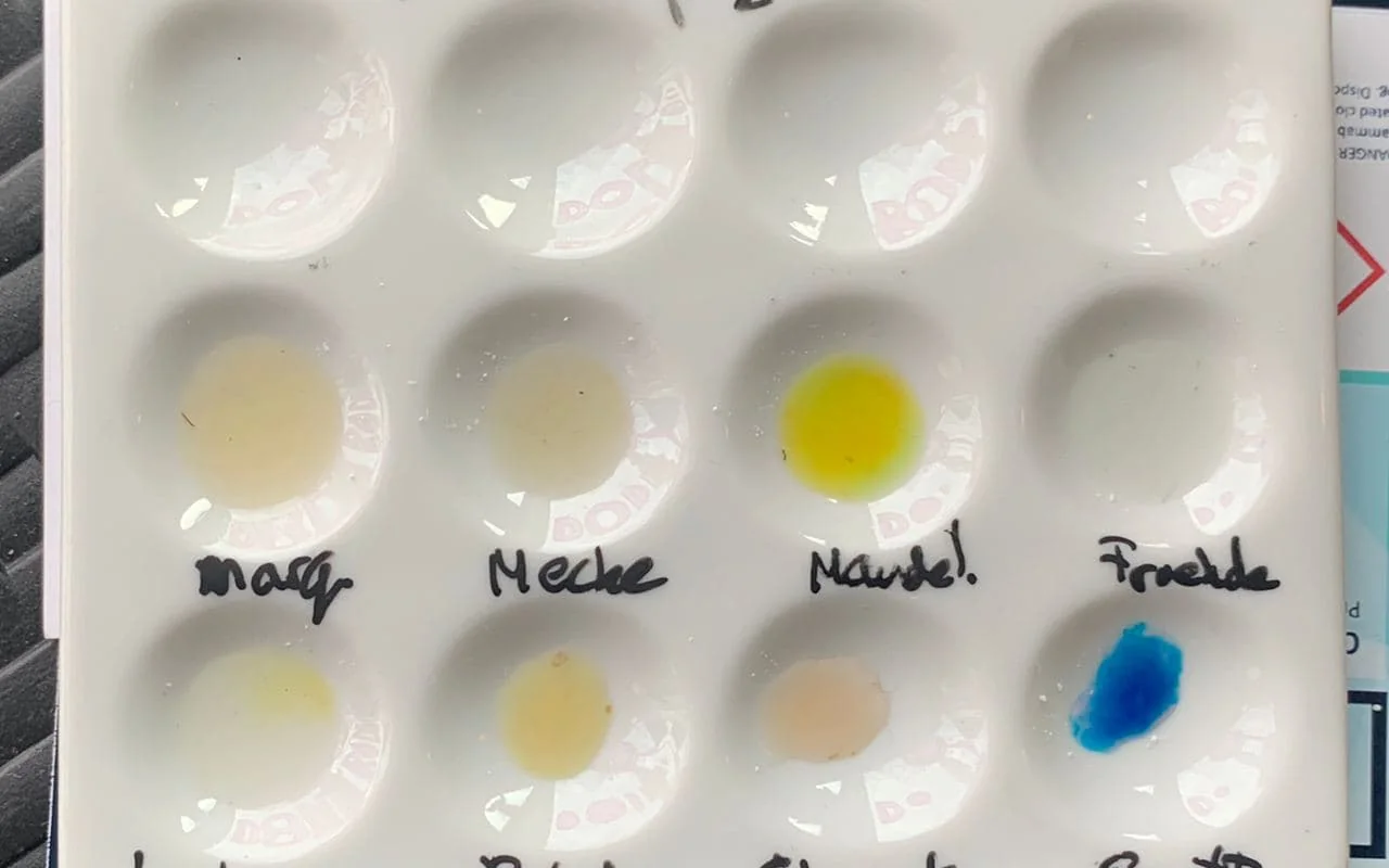 Is Mandelin reagent reliable?