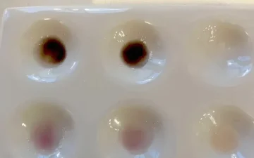 Robadope or Simon's reagent: which one you need
