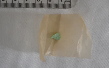 Small green pill fragment on paper, photographed beside a ruler