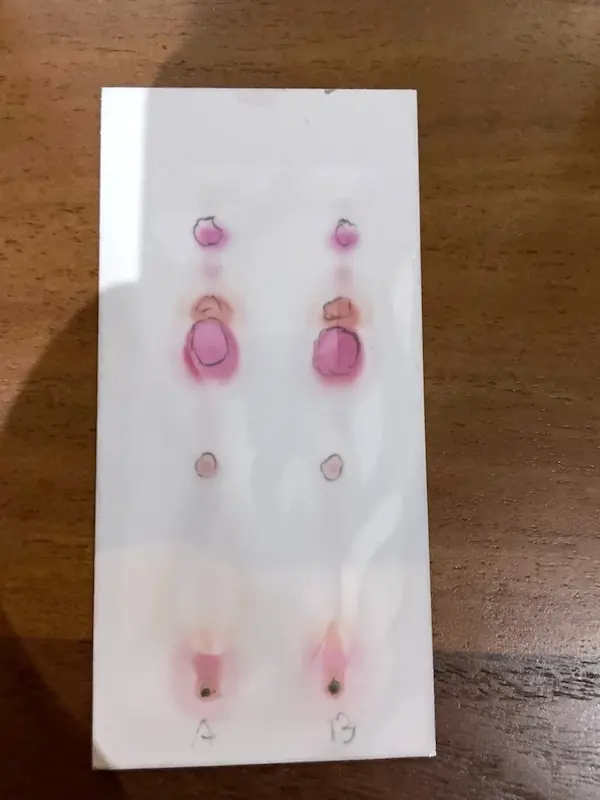 A developed cannabinoid testing card on a wooden table with two sample lanes marked A and B, each showing a column of pink and red spots circled in pencil