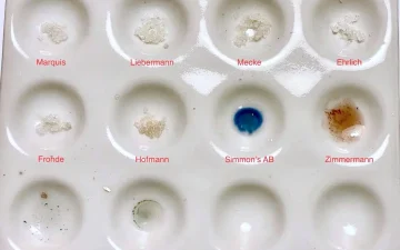 Reagent colour chart: how to read your result